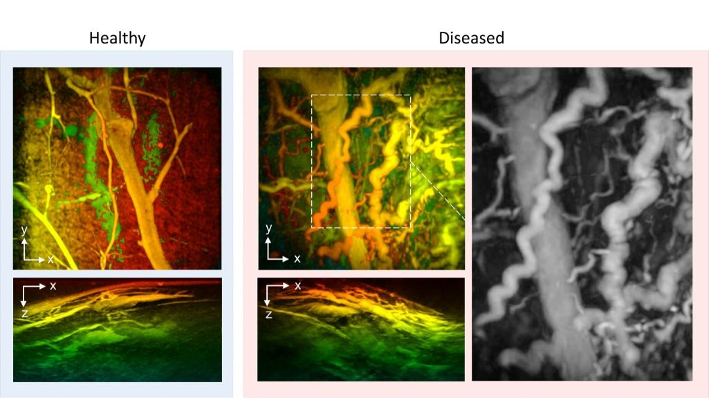 Handheld scanner promises real-time 3D imaging for early disease ...