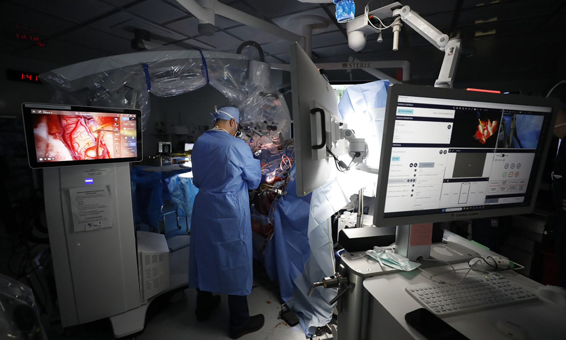 New brain-mapping technology enhances tumour surgery - Surgery ...